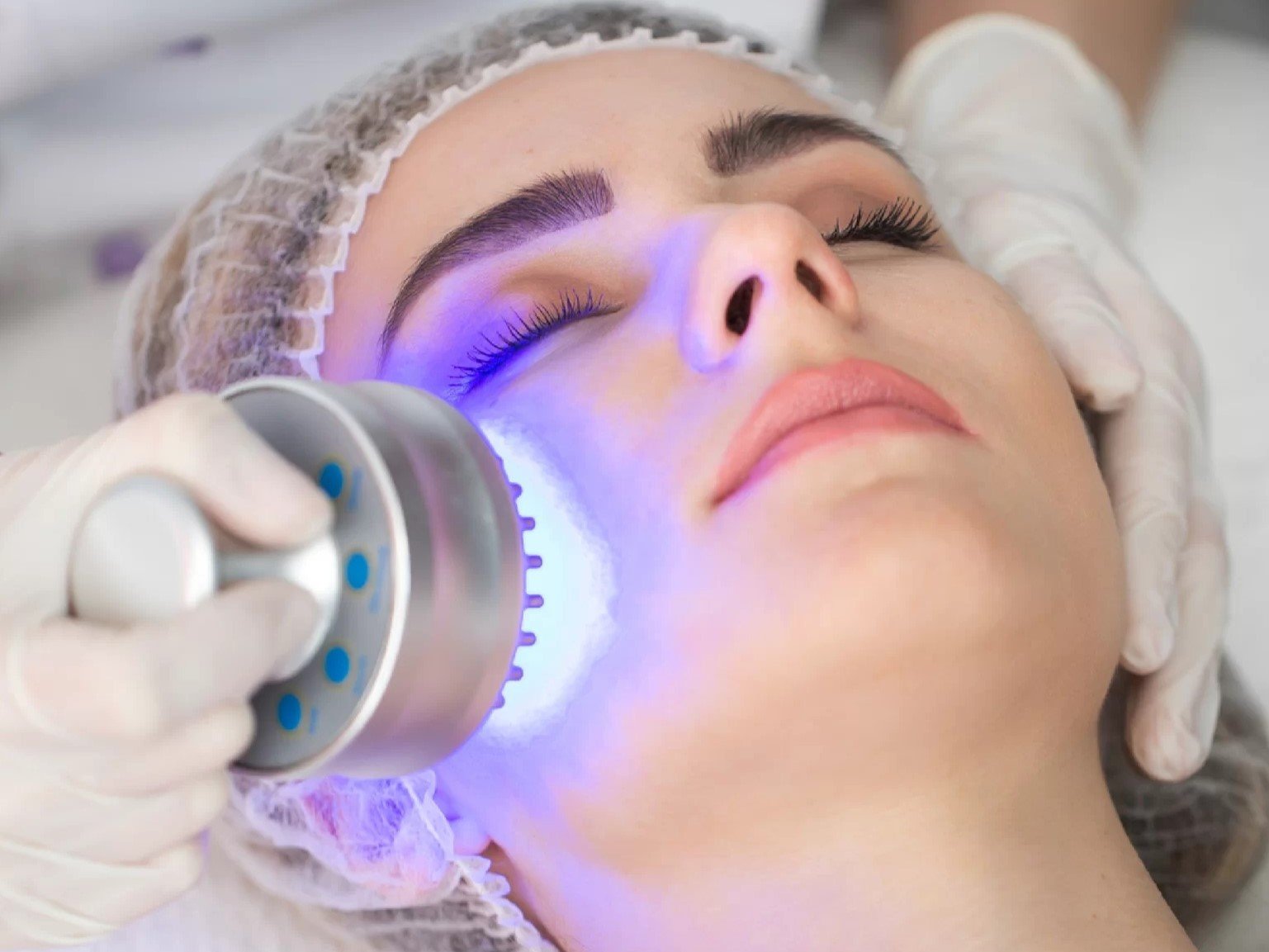 PRP treatment in progress