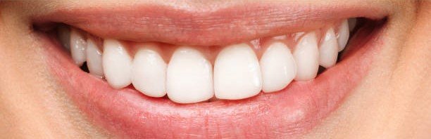 After teeth whitening